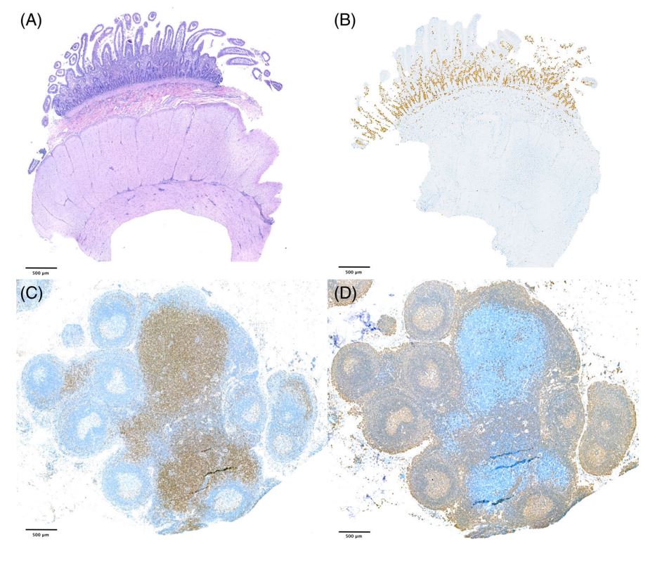 Linfoma intestinale del gatto: utilità della biopsia linfonodale mesenterica