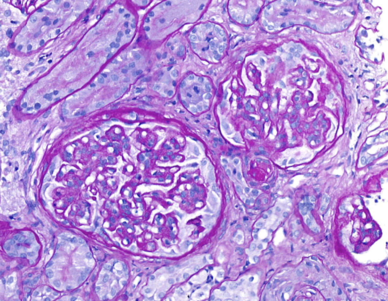 Glomerulopatie nel cane: recenti dati da uno studio retrospettivo europeo sulla sopravvivenza (European Veterinary Renal Pathology Service - EVRPS)